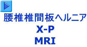 ŒŊԔwjA X-P MRI 